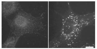 抗LC3（克隆号：LC3・1703）单克隆抗体                              Anti LC3 (Clone: LC3-1703) monoclonal antibody