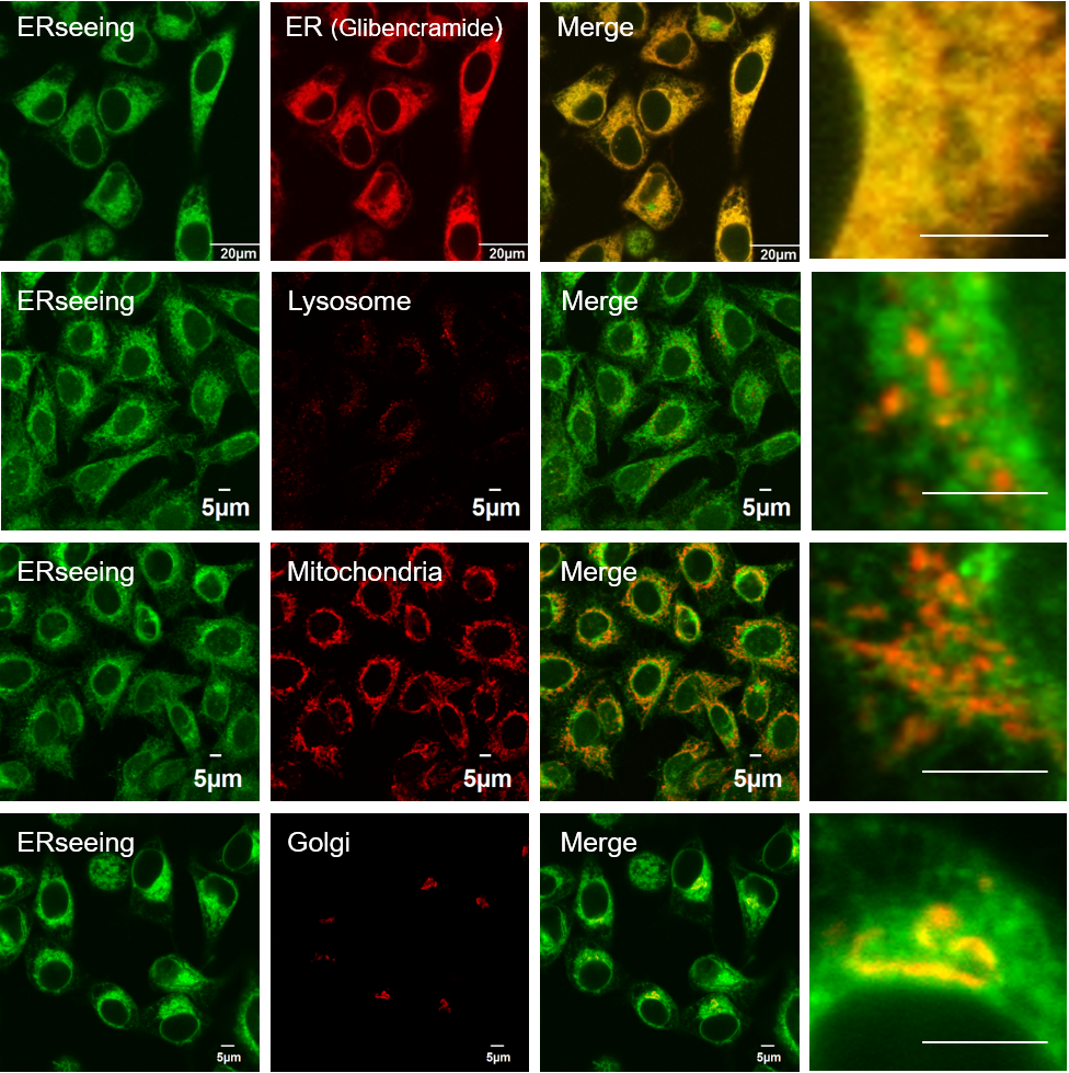 ERseeing ＜Endoplasmic Reticulum Green＞                              对活细胞影响少，适于长时间成像的ER染色试剂