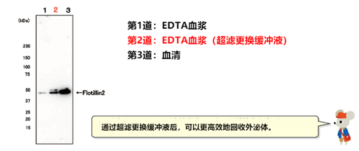 MagCapture™ 外泌体提取试剂盒                              MagCapture™ Exosome Isolation Kit PS