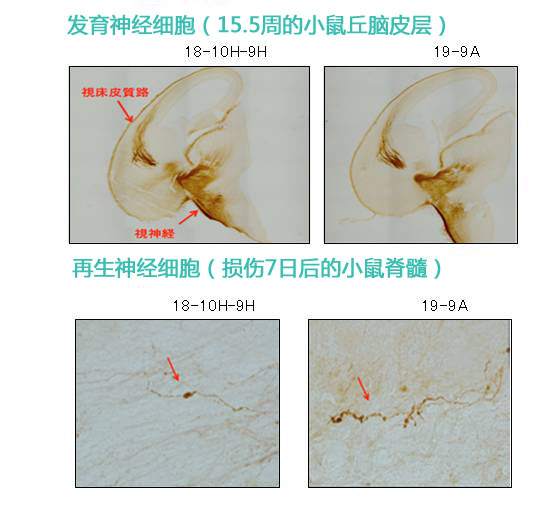 神经生长相关蛋白 GAP43 单克隆抗体