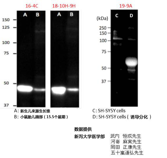 神经生长相关蛋白 GAP43 单克隆抗体